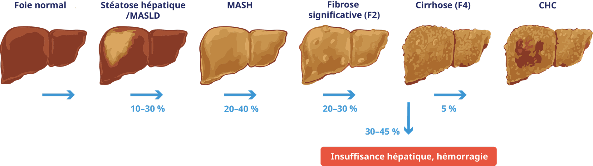 liver