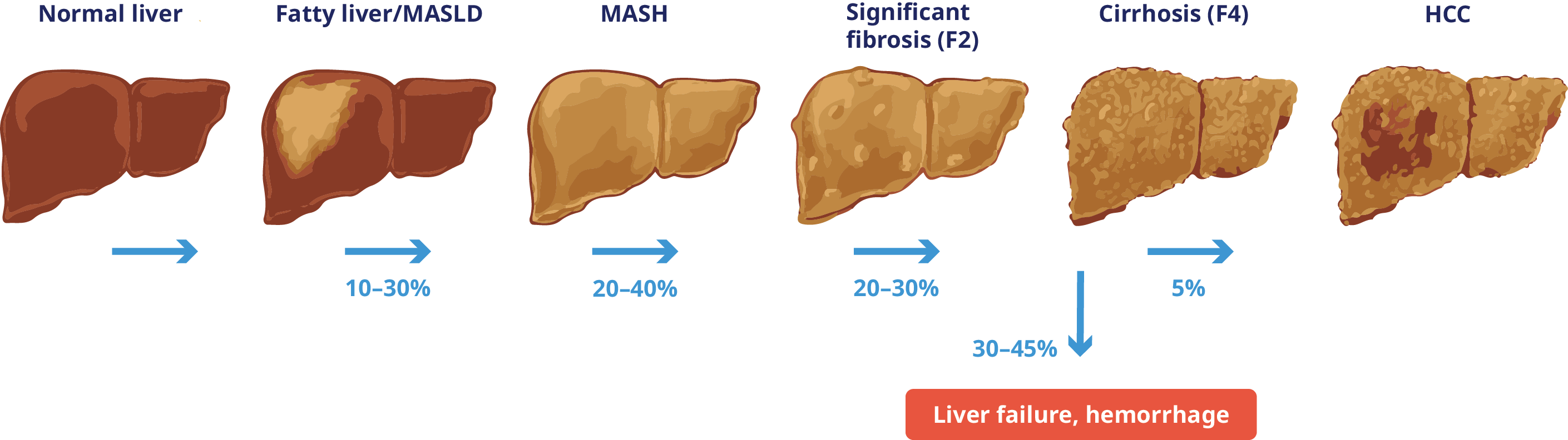 liver